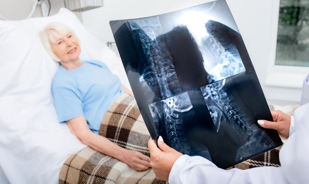 osteochondrosis diagnózisa